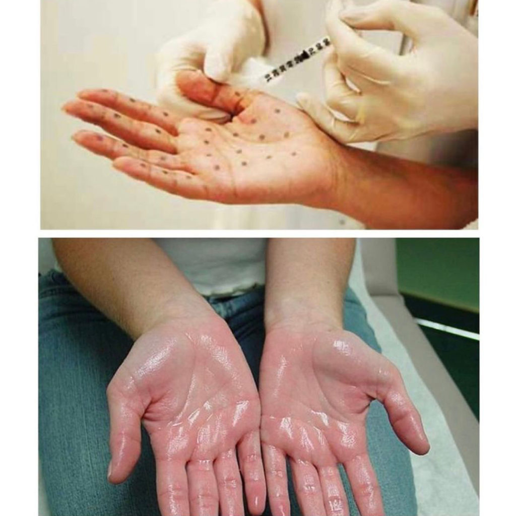 get a vaccine